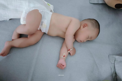 延边宝宝头上长痱子